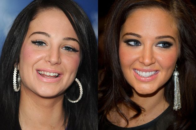 Ces Stars Qui Ont Refait Leurs Dents