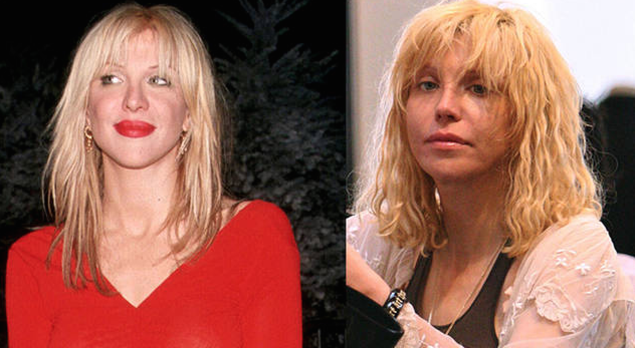 Courtney-Love http-::www.elle.fr:People:La-vie-des-people:News:Stars-les-rates-de-la-chirurgie-esthetique:Courtney-Love:Stars-les-rates-de-la-chirurgie-esthetique