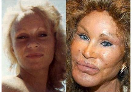 Maquillage raté de stars : les dégâts de la poudre matifiante