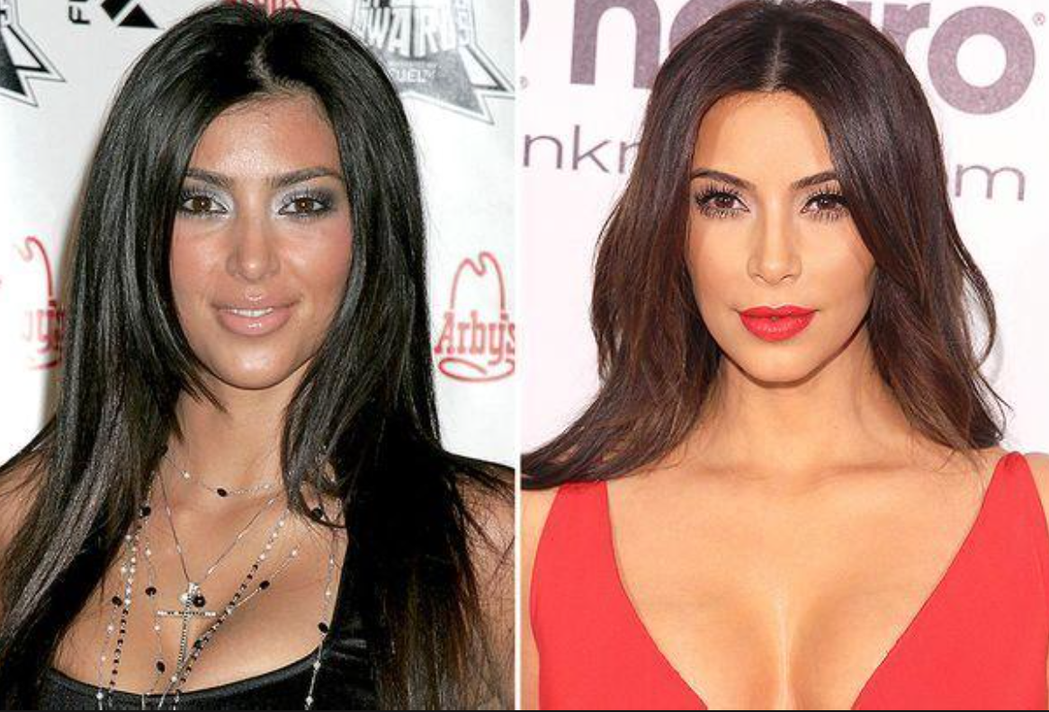 Kim, Kylie, Khloé … L’incroyable transformation des Kardashian 19