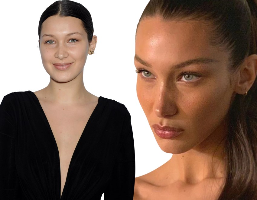 bella hadid avant chirurgie