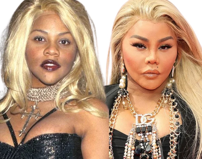 lil kim avant apres jeune chirurgie esthetique