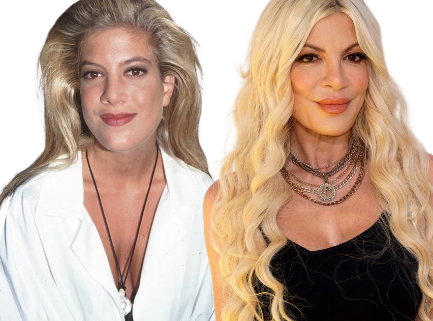 tori spelling avant jeune chirurgie esthetique ratée