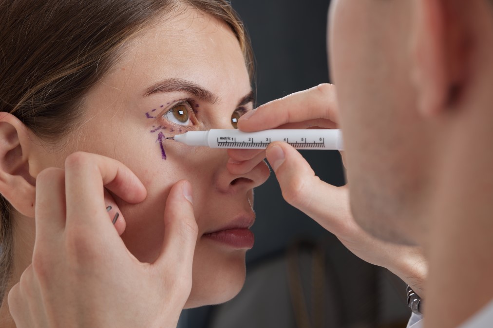 blépharoplastie paupières tombantes